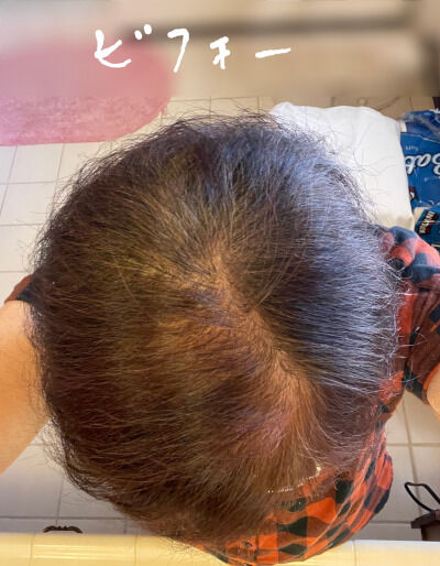 2024-10-21-hair2