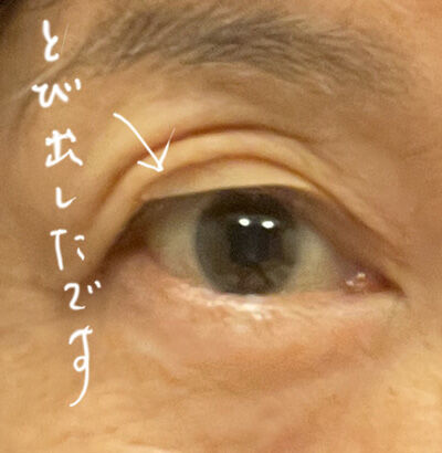 2023-06-03-eyesticker6.