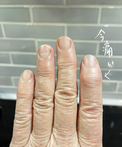 2023-02-23-finger1