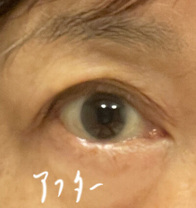 2023-06-03-eyesticker5.
