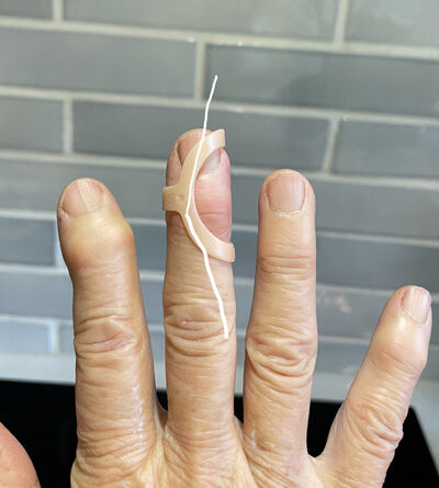 2023-03-04-splints4
