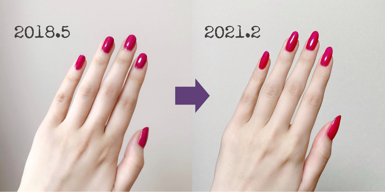 手指の垢抜け方法 ちこえ Official Blog Powered By ライブドアブログ