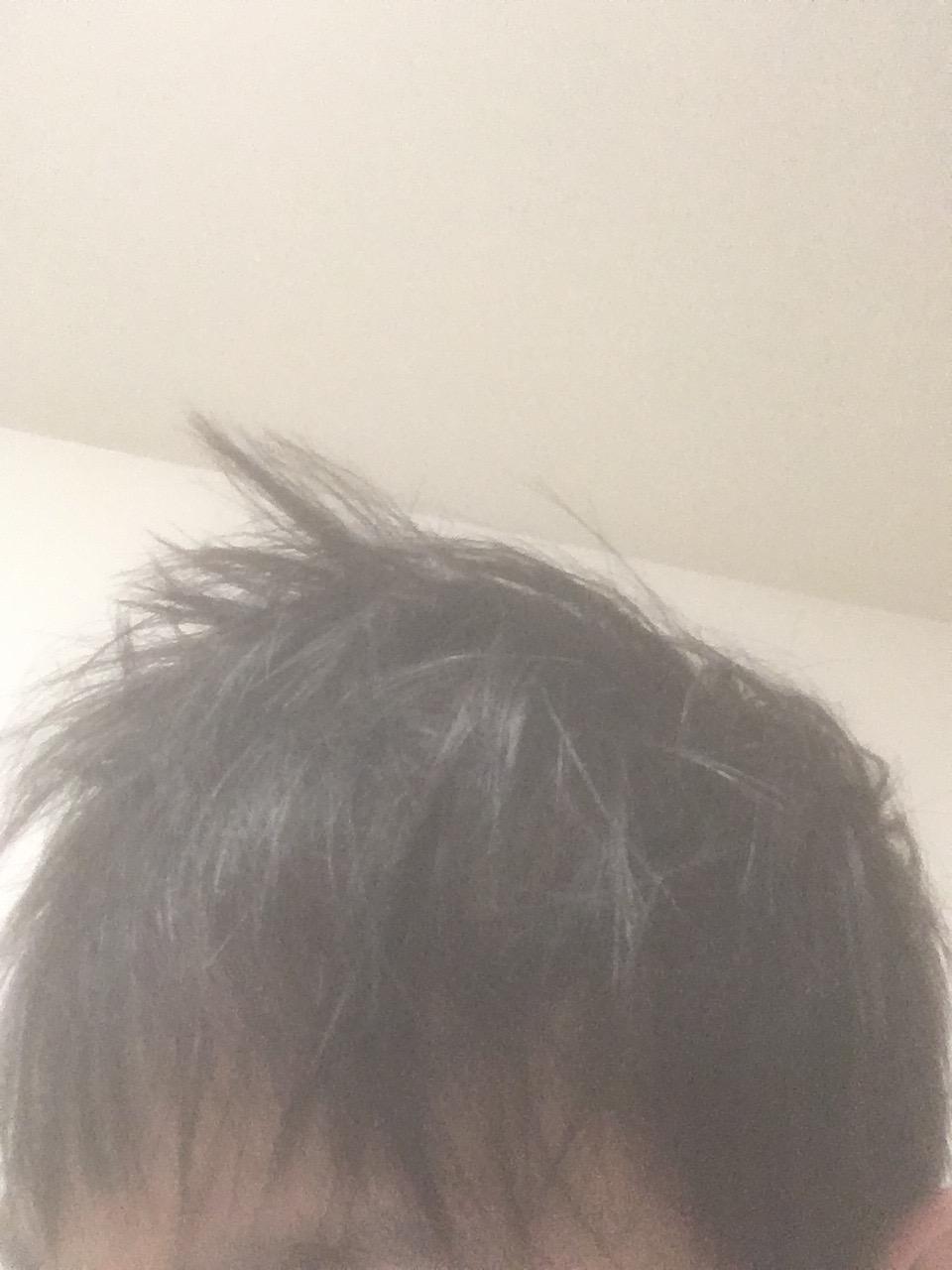 悲報 ぼく 縮毛矯正かけて失敗する チー牛まとめ