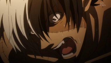 ヤング ブラック・ジャック 5話 感想 画像0