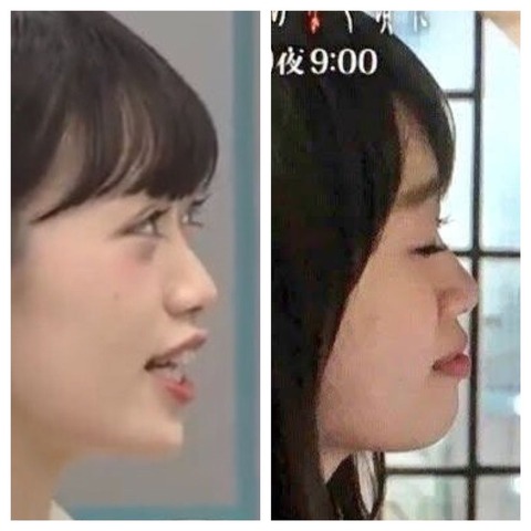 【AKB48G】コロナ騒動の間にちゃっかり整形して顔が変わって復帰しそうなメンバーｗ