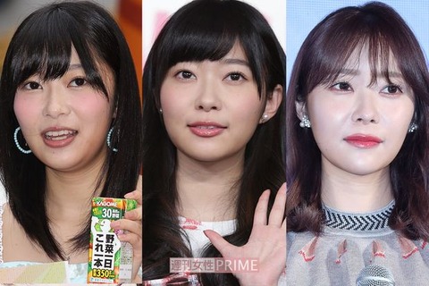 【朗報】美容整形外科医「指原莉乃の顔が変わったのは歯列矯正、加齢による顔痩せとメイク」