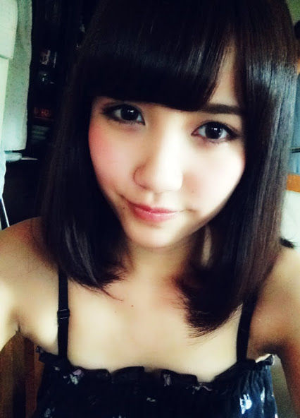 【悲報】AKB48加藤玲奈、アテロームにより休養