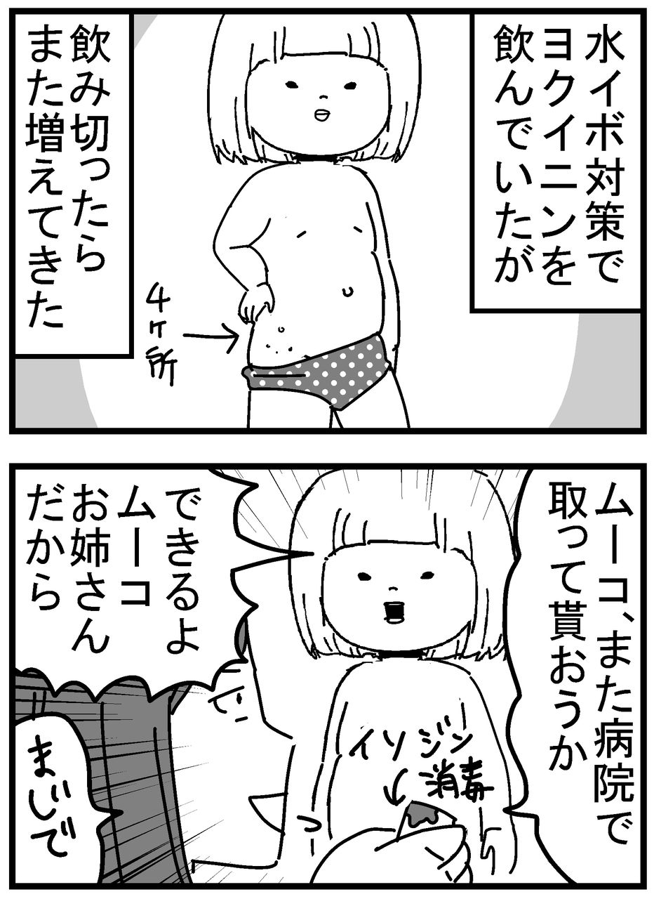 育児漫画166 水イボその後 千曲がり奮闘記 紆余曲折の育児記録 Powered By ライブドアブログ 育児漫画166 水イボその後 千曲がり奮闘記 紆余曲折の育児記録 Powered By ライブドアブログ