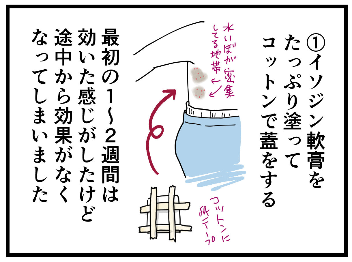 ナナオと水イボその後１ 千曲がり奮闘記 紆余曲折の育児記録 Powered By ライブドアブログ