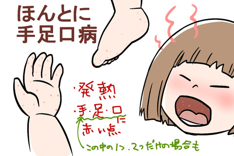 手足口病1