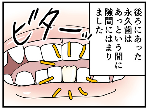 76-11