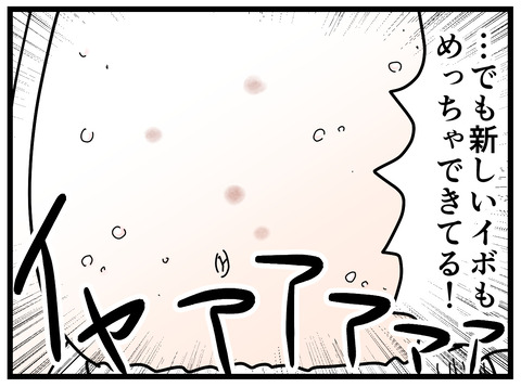 72-15
