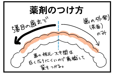 歯3