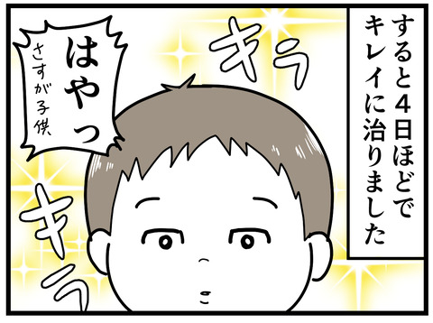 33-5