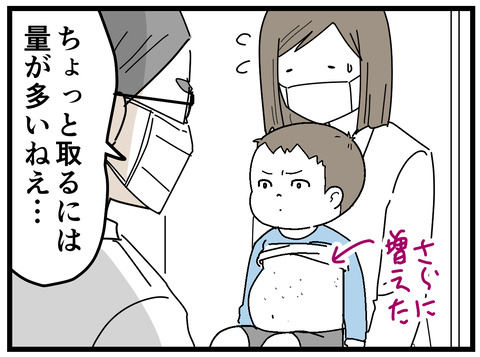 72-5