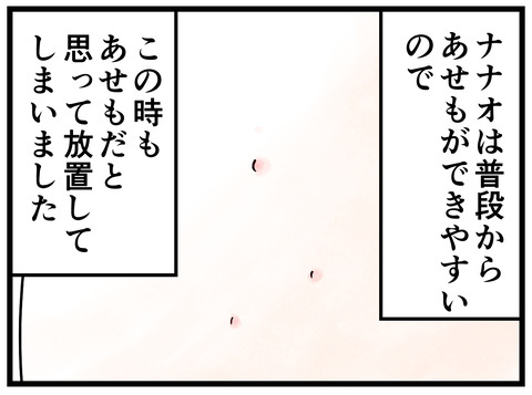 71-2