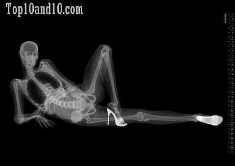 Sexy-models-under-X-ray-12