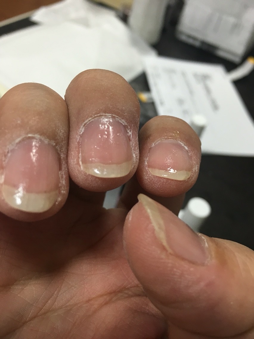 コンドルの爪に グラスネイルはイイぞ ランラン日記王