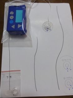 模型2