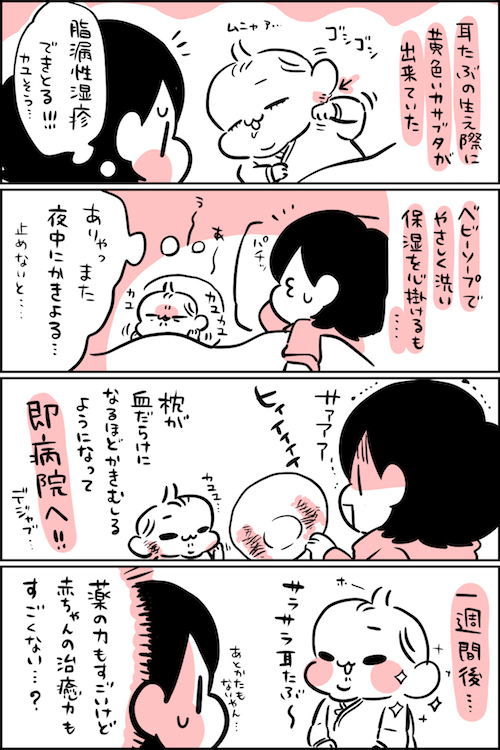 脂漏性湿疹 ちひろのスキブログ 主婦の日常マンガ Powered By ライブドアブログ 脂漏性湿疹 ちひろのスキブログ 主婦の日常マンガ Powered By ライブドアブログ