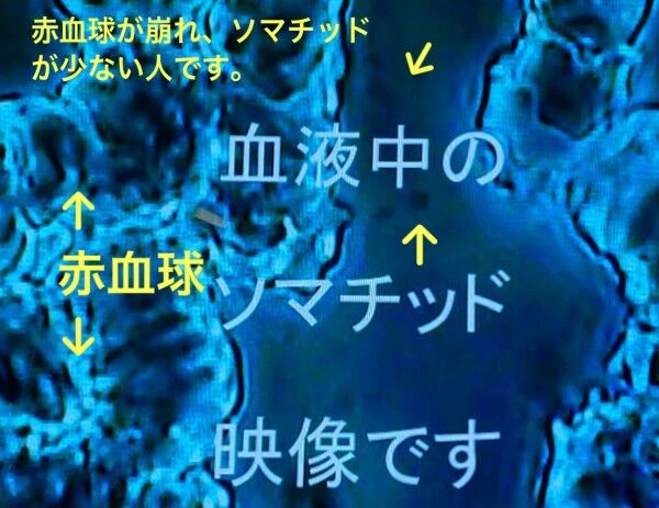 完売🙏】櫻井喜美夫先生 最新最強 ソマチッド入りテラヘルツ波