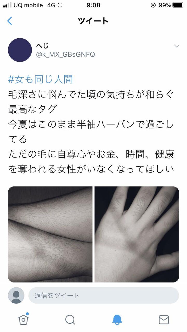 悲報 Twitter女子ら すね毛や腕毛を伸ばし始める 女も同じ人間 なんjまん 悲報 Twitter女子ら すね毛や腕毛を伸ばし始める 女も同じ人間 なんjまん