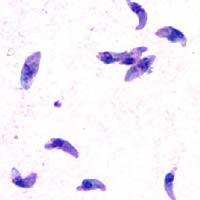 Toxoplasma_gondii_tachy