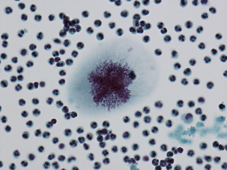 細胞診専門医試験 病理内視鏡医の育つまで