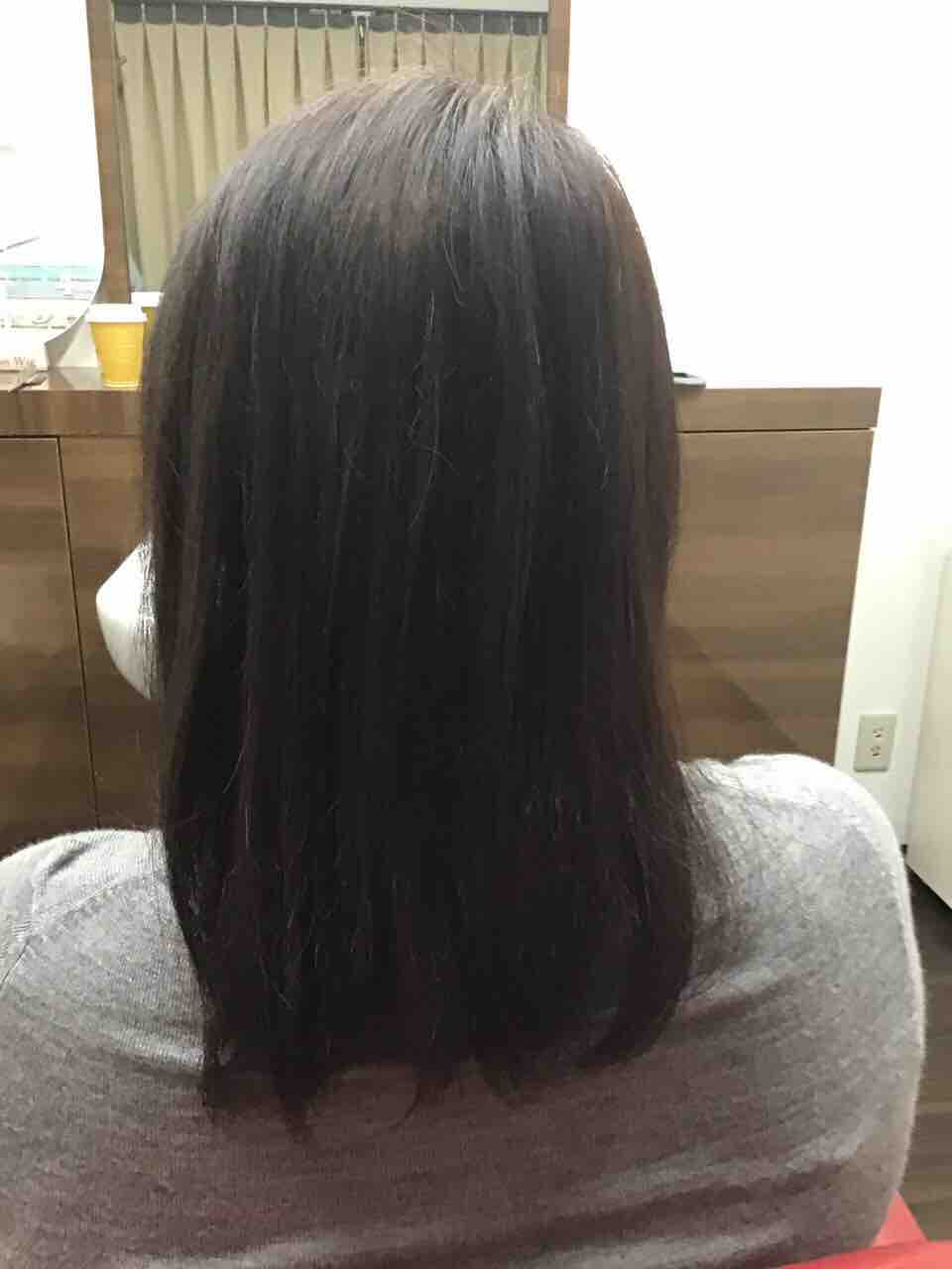 抜毛 癖 マジ注意 くせ毛を抜くのは超リスキー 癖で天パを抜き続ける末路とは 抜毛 癖 マジ注意 くせ毛を抜くのは超リスキー 癖で天パを抜き続ける末路とは