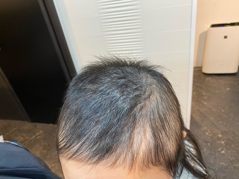 抜毛抑制ウィッグ-