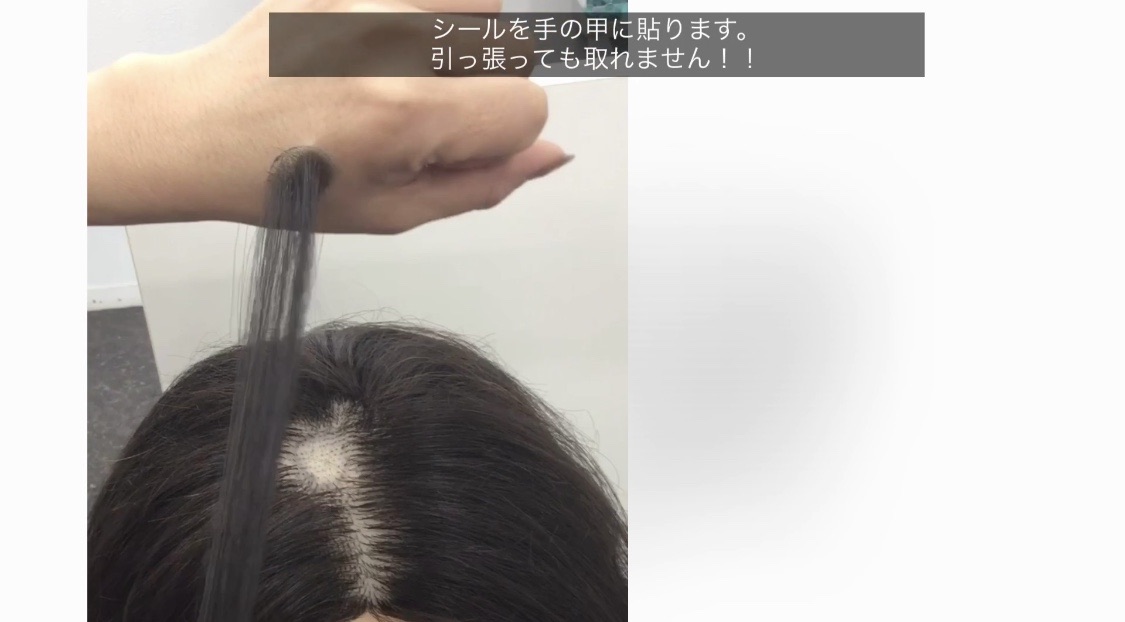 円形脱毛症 脱毛症に貼るウイッグ ステイホームで購入可能 神戸 紫光美容室