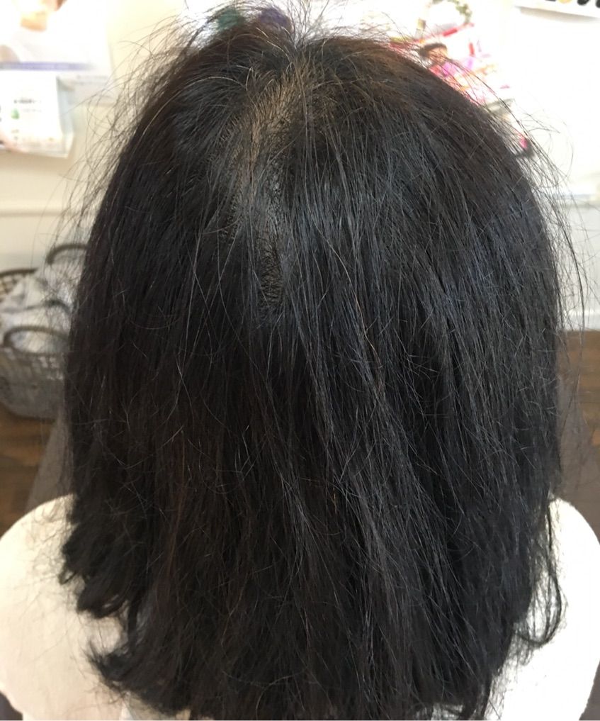 増毛って 神戸市北区 美容室 神戸 紫光美容室