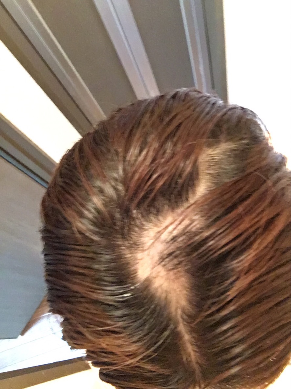 抜毛症対応美容師 東京出張 神戸 紫光美容室