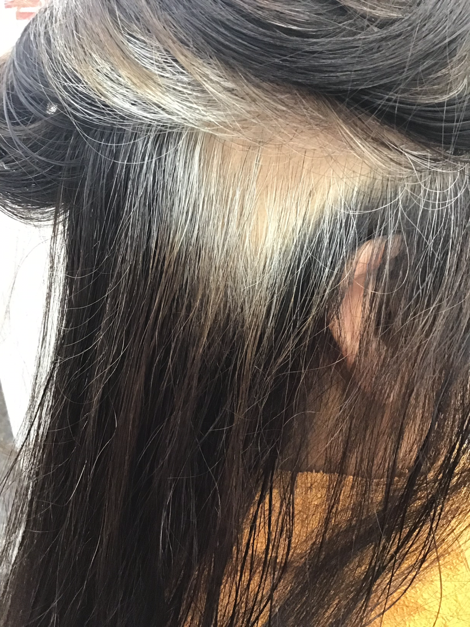 抜毛症 髪が生えない 神戸 紫光美容室