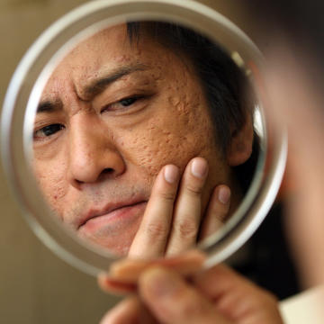 画像 ブラマヨ吉田のお肌がスベスベになって気持ち悪いと話題に 芸人ずかん 画像 ブラマヨ吉田のお肌がスベスベになって気持ち悪いと話題に 芸人ずかん