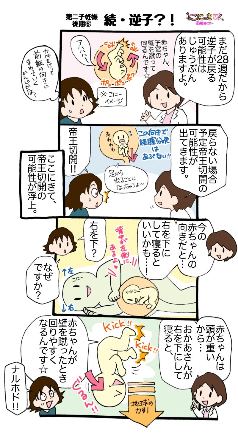 397 続 逆子 第二子妊娠後期 こにっき あま田さんちの陽気な育児漫画 397 続 逆子 第二子妊娠後期 こにっき あま田さんちの陽気な育児漫画