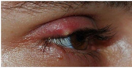 イギリス反応 日本の小学生たちに 眼球なめ が流行 海外反応 クールジャパン