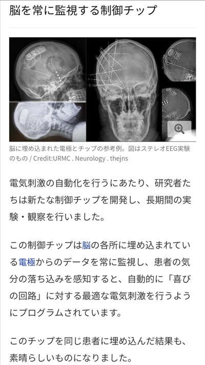 Mdk8bJX