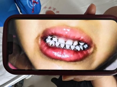 ltlAXFG