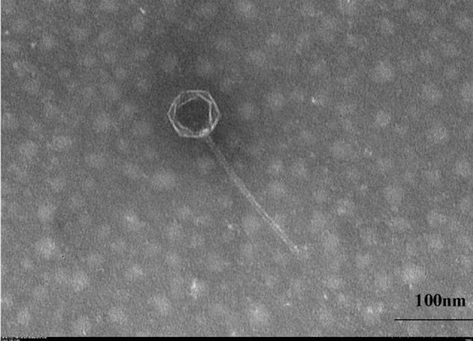 マリアナ海溝の水深約9000メートルで新種のウイルスを発見「最も深くから分離されたバクテリオファージ」と科学者！