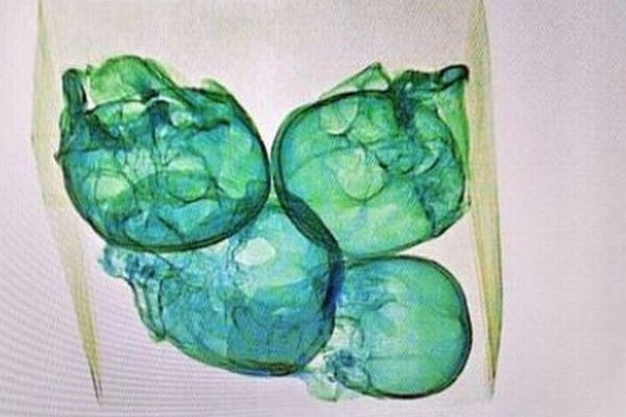 メキシコの空港で、人間の頭蓋骨4個が入った小包を発見…最も暴力的なミチョアカン州で！