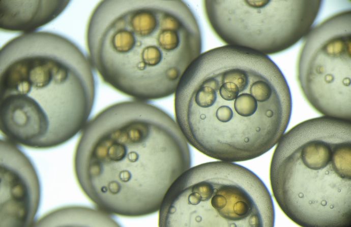 「まるでSF映画」31年間凍結されていた受精卵で赤ちゃん誕生…米オハイオ州！