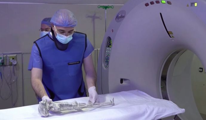 宇宙人の死体？をエックス線などで検査「人工的に操作の痕跡ない」…メキシコ！