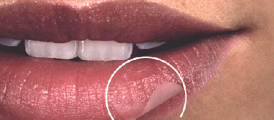 取れる まで 口唇 ヘルペス かさぶた Q&A｜アクチビアの使用に関するQ&A｜口唇ヘルペスの再発治療薬：アクチビア軟膏