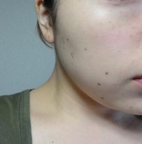 After