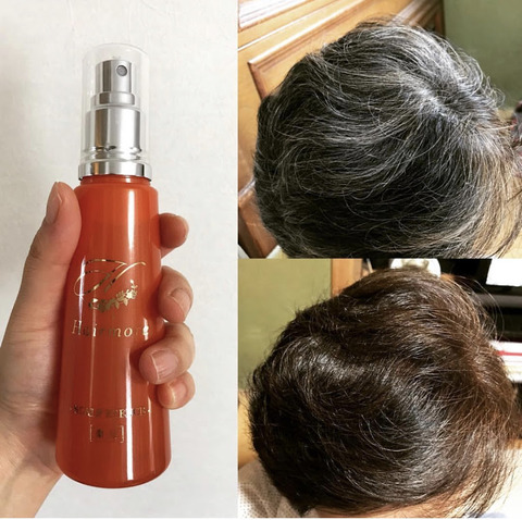 薬用 Hairmore ヘアモア スカルプエッセンス コスメ大好きコス子のブログ 薬用 Hairmore ヘアモア スカルプエッセンス コスメ大好きコス子のブログ