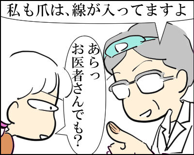 爪　バッファー１