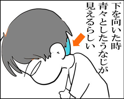 ツーブロック 14