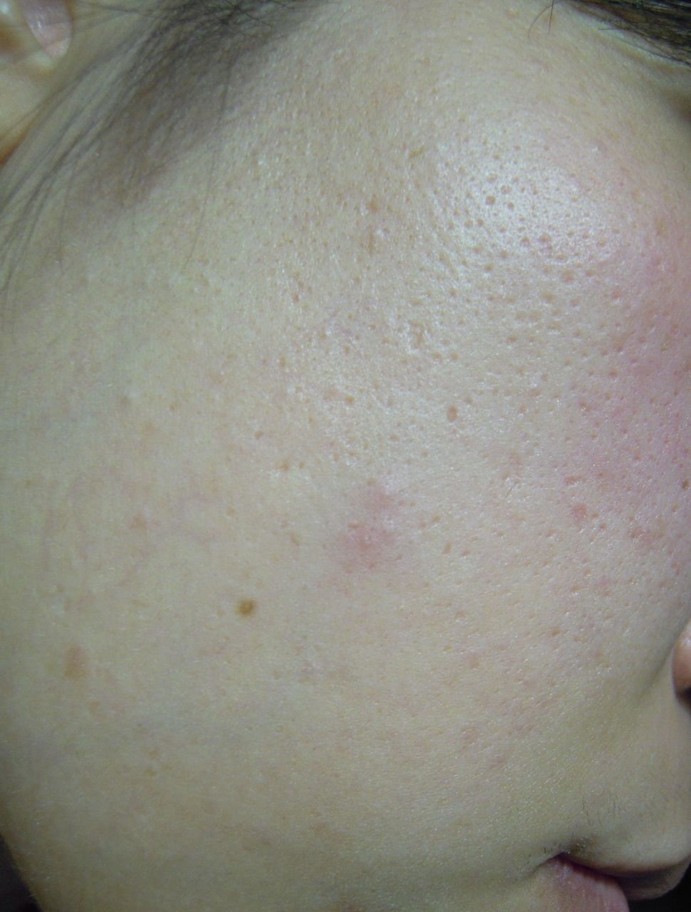 現在のお肌の状態 美髪効果 湯シャン脱シャンプーお湯洗髪