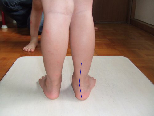 子供の足の発達についての講演 Frau伊藤の快適生活と足育のススメ